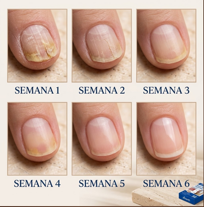 Arizona Uñas Sanas · Parches para Uñas Amarillas x32